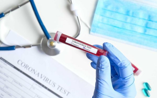 azerbaycanda-koronavirus-ile-bagli-son-veziyyet-aciqlandi-keskin-artim